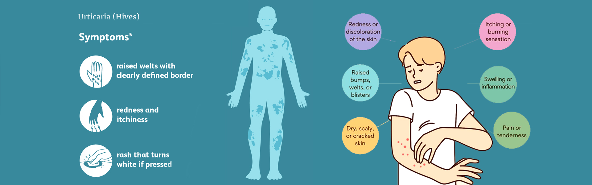 What are the of causes hives? | What are the symptoms of hives? | How long do hives last? | When to seek medical treatment for hives? | How are the hives treated and cured? | Various pictures of hives | diseases that cause hives in adults male and female | what are the Causes of hives in female adults | Can hives be a sign of something serious diseases |Various treatment of hives | How to cure hives fast and quick | Pictures of hives rash on legs and hand